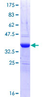 12.5% SDS-PAGE Stained with Coomassie Blue.